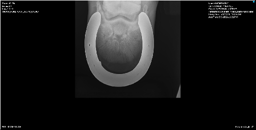 Right Forefoot D65PR PADIO